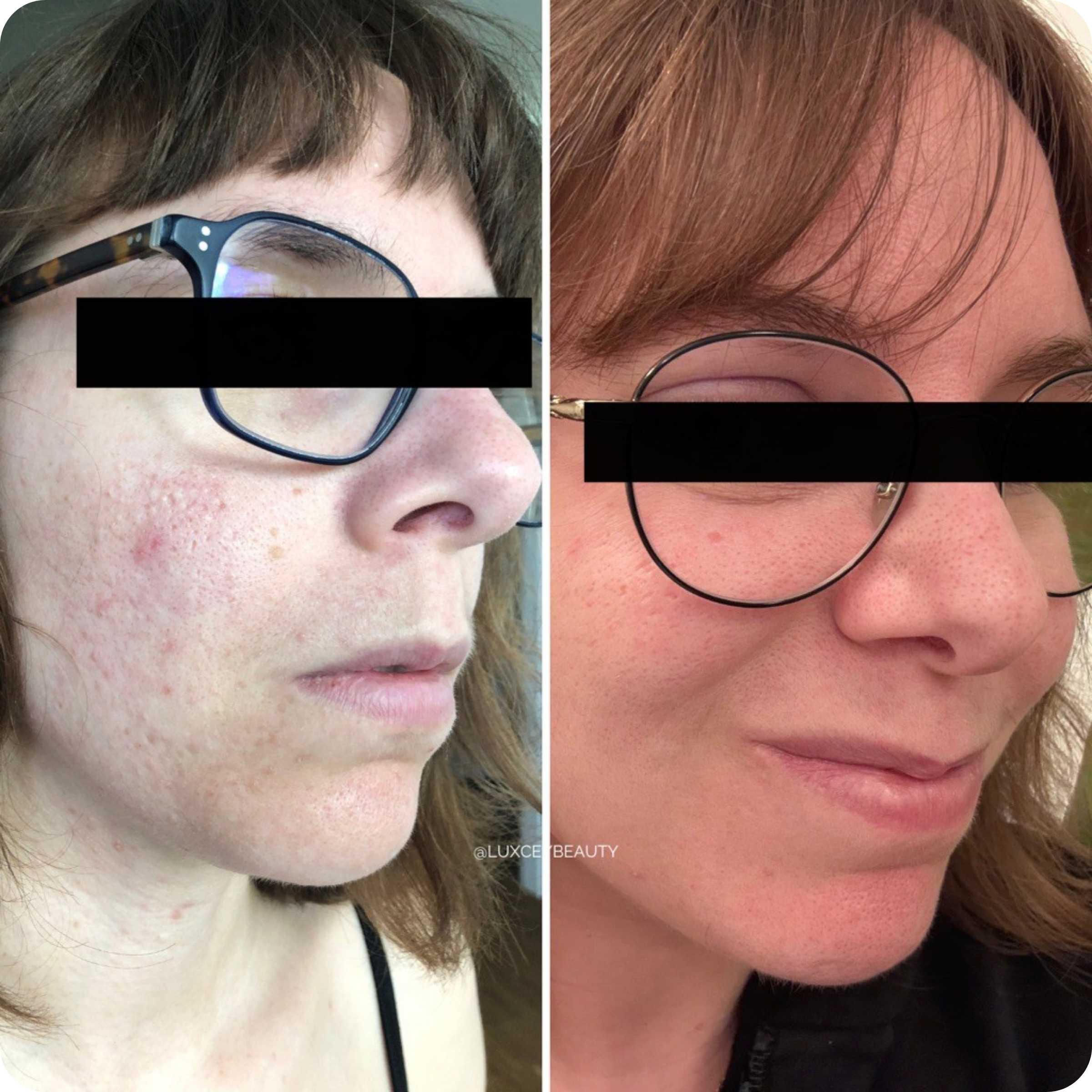 Ulysse - Nettoyant et Masque Lumière